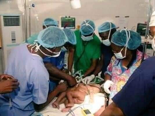 For the Third Time, FMC in Yola Successfully Separates Another Co-joined Twins
