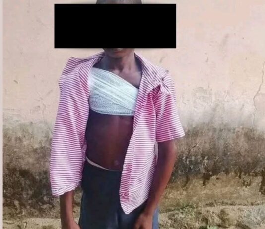 Police Dispute Brutality Claims as Akwa Ibom Schoolboy is Hospitalized